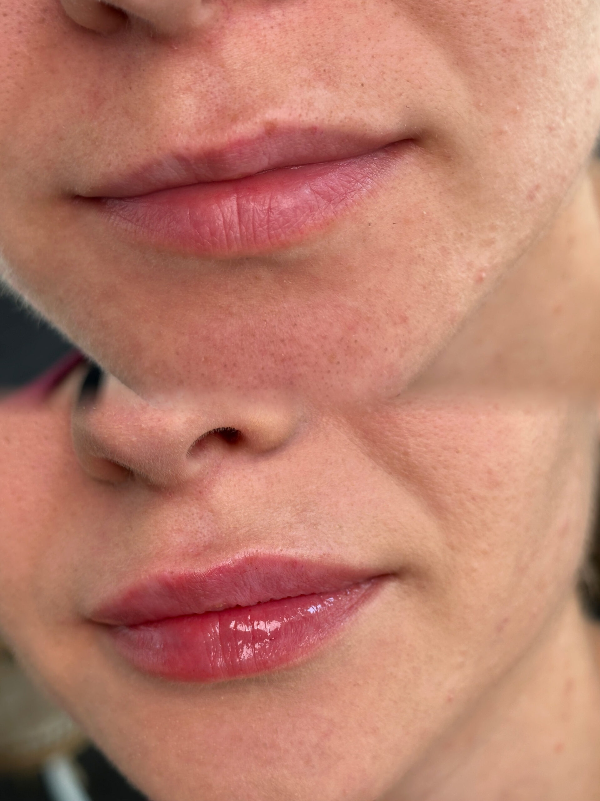 {"ARInfo":{"IsUseAR":false},"Version":"1.0.0","MakeupInfo":{"IsUseMakeup":false},"FaceliftInfo":{"IsChangeEyeLift":false,"IsChangeFacelift":false,"IsChangePostureLift":false,"IsChangeNose":false,"IsChangeFaceChin":false,"IsChangeMouth":false,"IsChangeThinFace":false},"BeautyInfo":{"SwitchMedicatedAcne":false,"IsAIBeauty":false,"IsBrightEyes":false,"IsSharpen":false,"IsOldBeauty":false,"IsReduceBlackEyes":false},"HandlerInfo":{"AppName":2},"FilterInfo":{"IsUseFilter":false}}